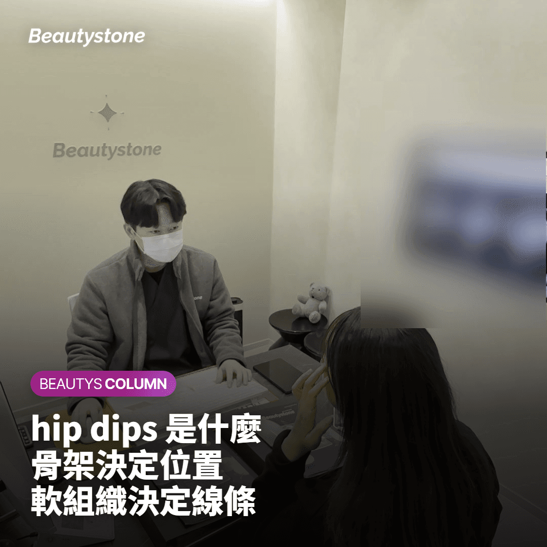 hip dips 是什麼？臀凹陷先看是骨架、肌肉還是鬆弛