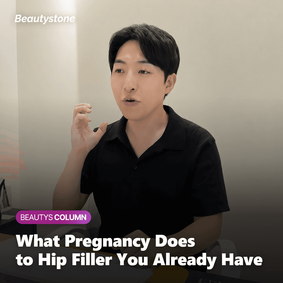 Illustration of how pregnancy and birth affect hip filler results