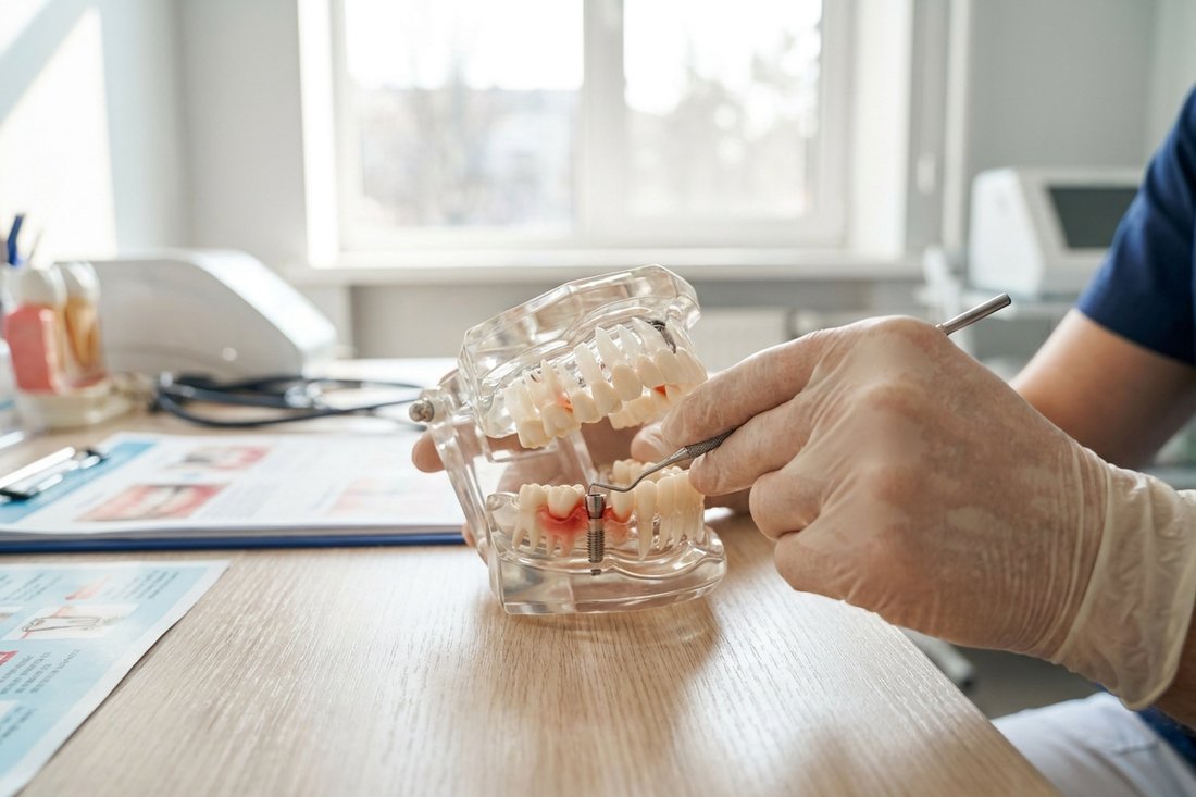 Dentist pointing to gum inflammation on a jaw model with a dental implant