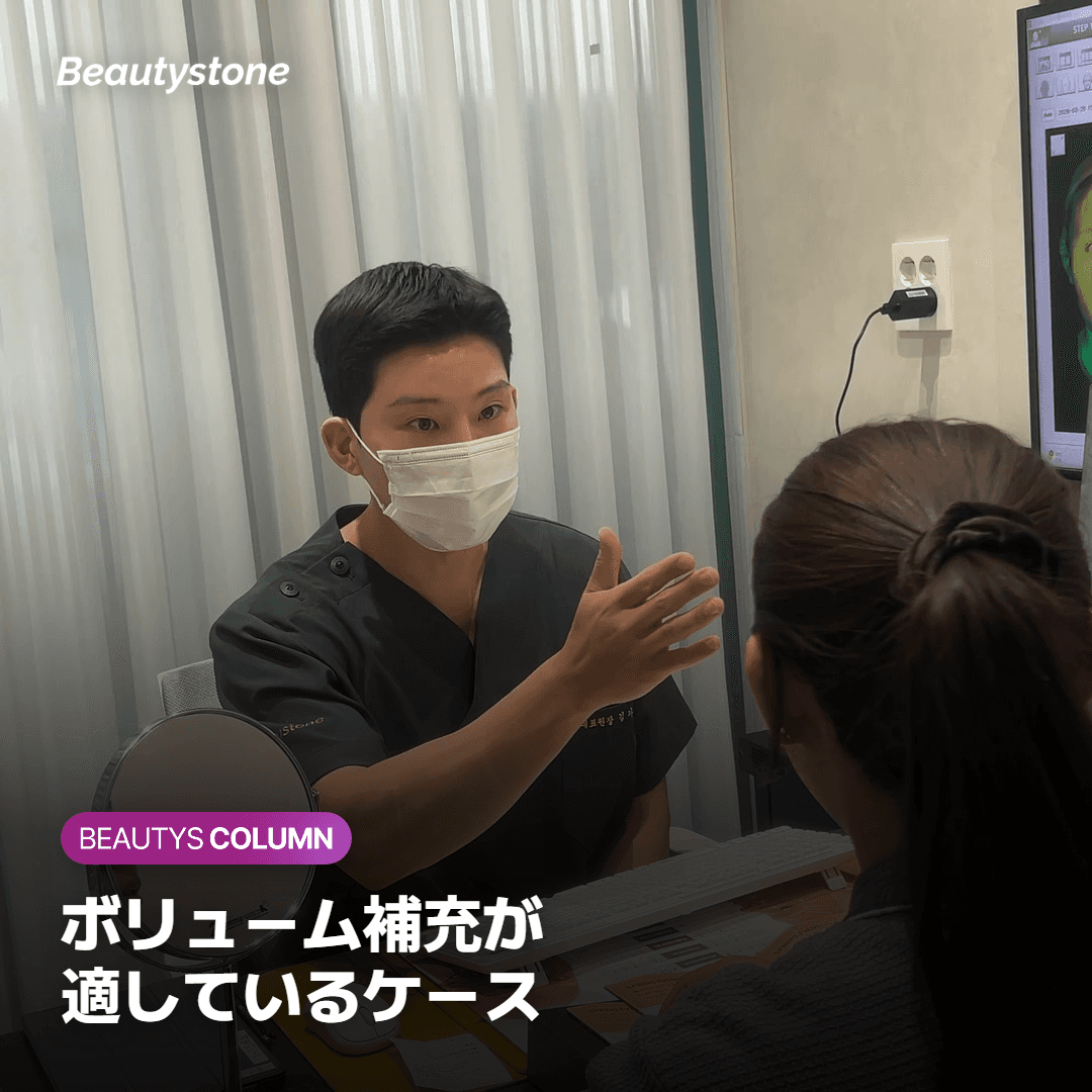 ボリューム補充が適しているほうれい線のケースと選び方