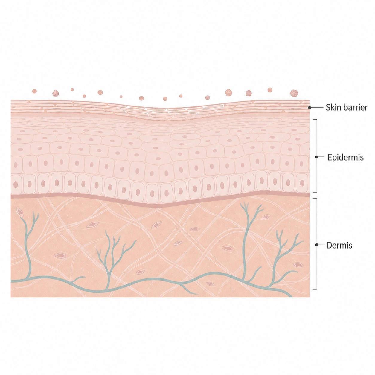 The skin barrier temporarily thinned after a procedure