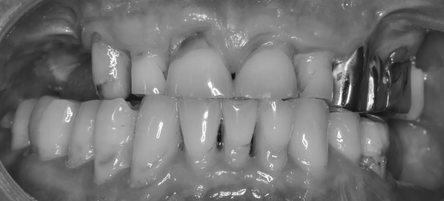 Examples of complex cases treated