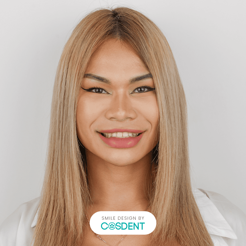 หน้าเหลี่ยม ยิ้มกว้าง 20 ซี่