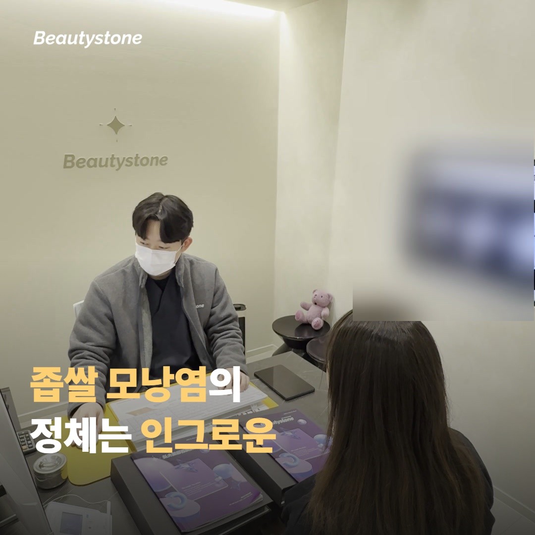 면도 후 좁쌀 모낭염이 왜 반복되나