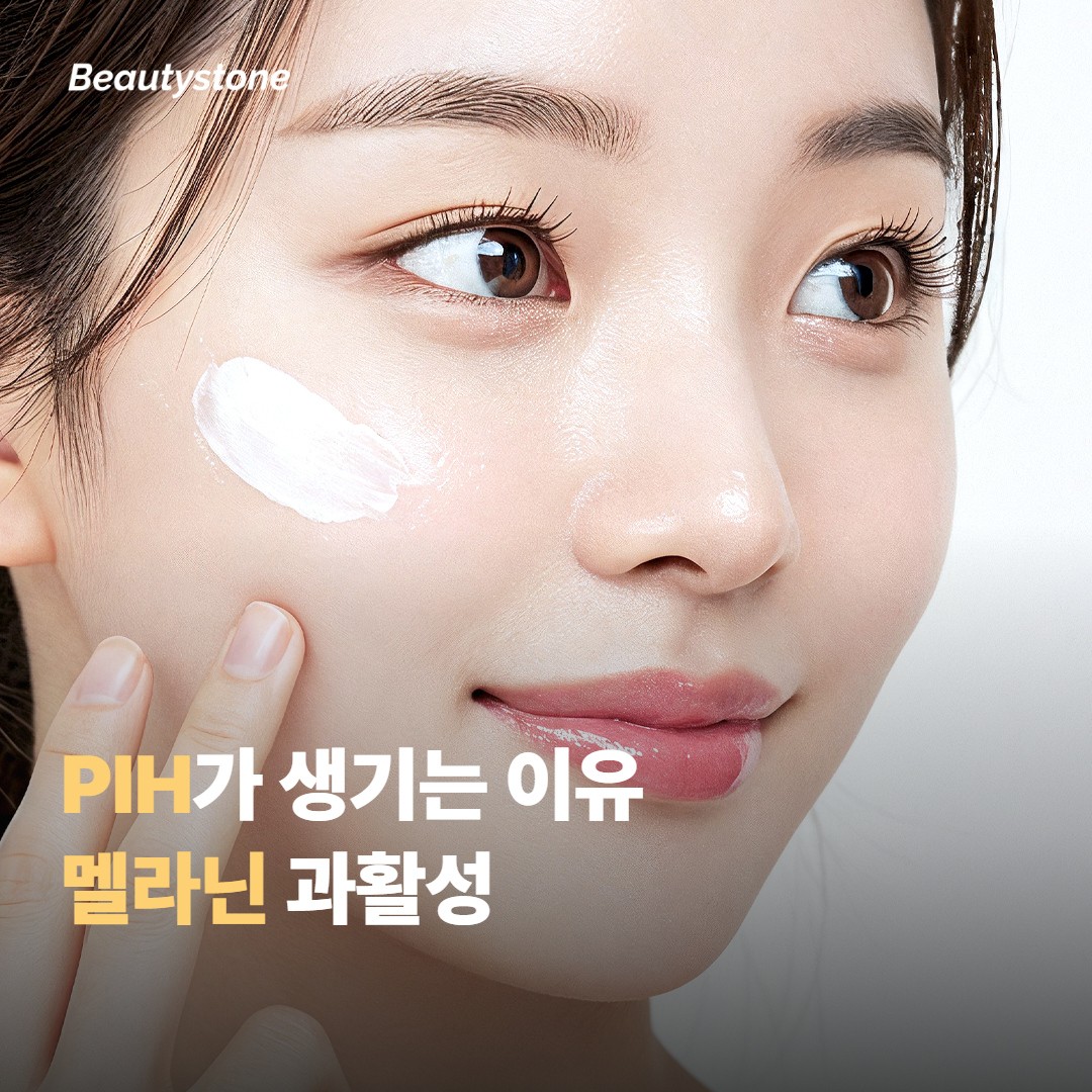 포텐자 후 색소침착은 왜 생길까