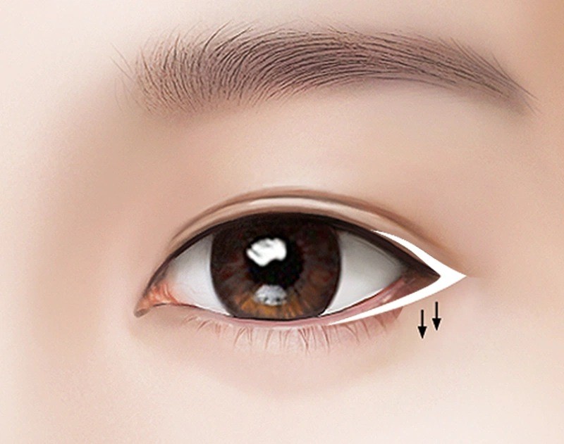 Phương pháp nhấn mí để tạo hình dáng mắt sắc nét, cân đối và đầy cuốn hút
