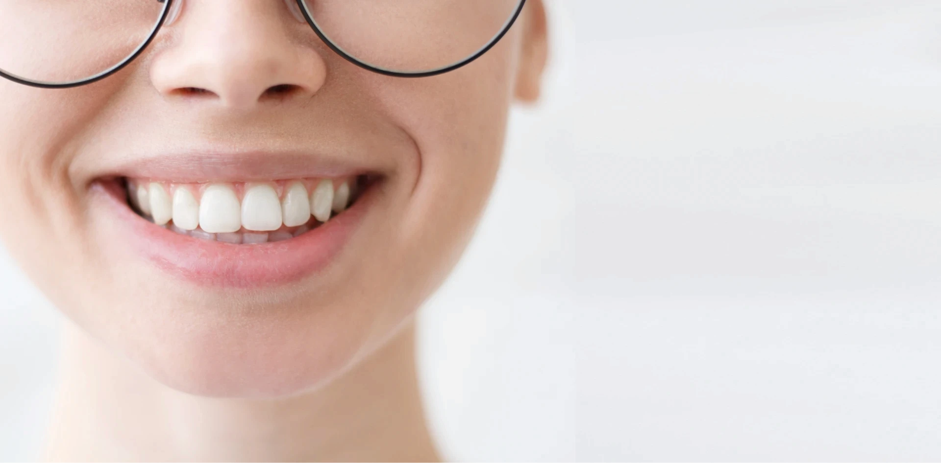 Kobieta z uśmiechem prezentująca efekty bondingu na swoich zębach.