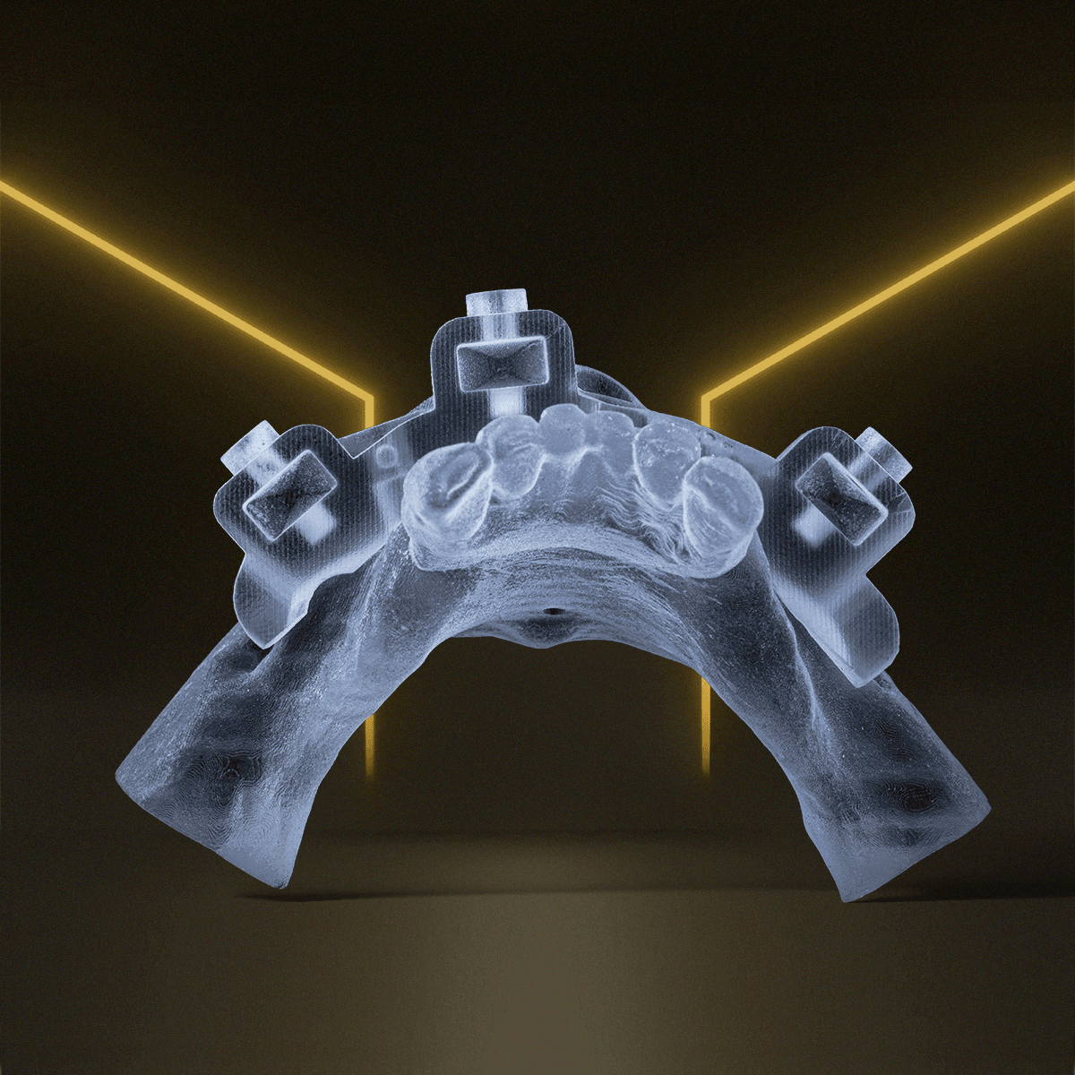 Digital Treatment Planning