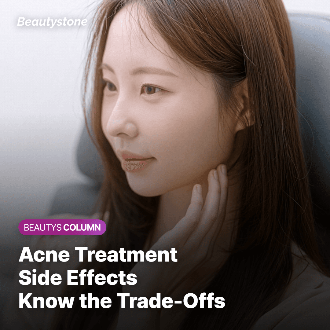 Acne Treatment Side Effects Know the Trade-Offs