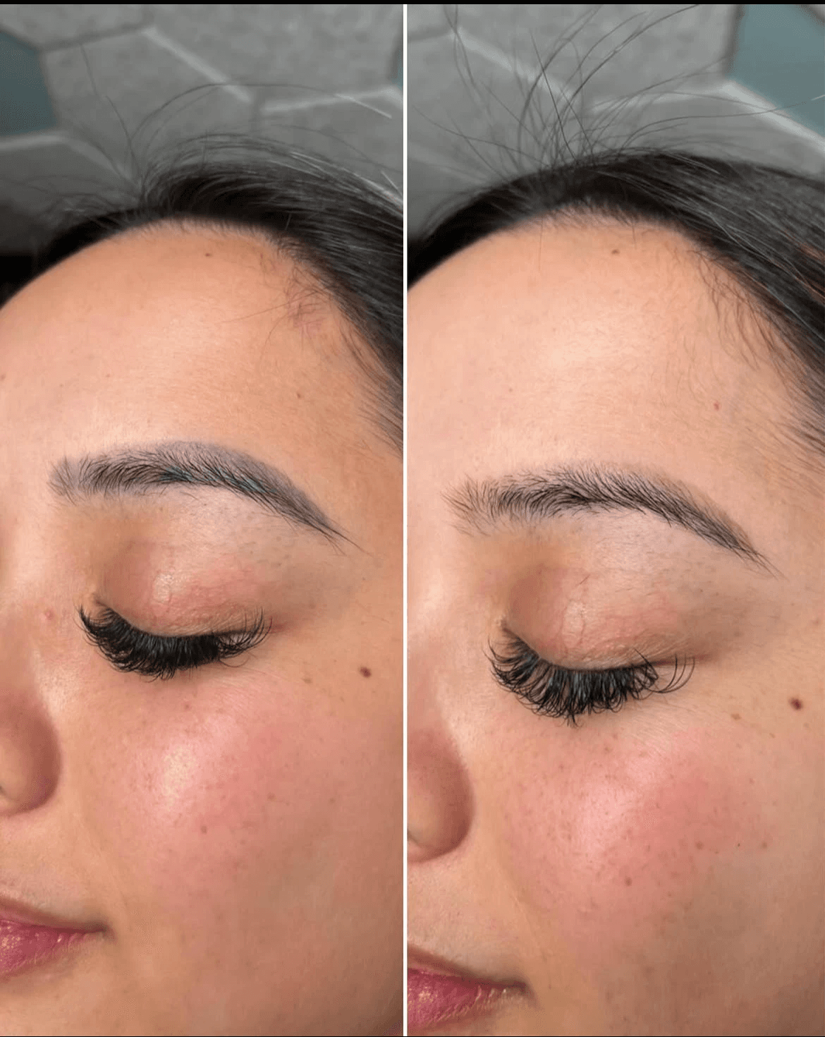 PMU & Microblading entfernen