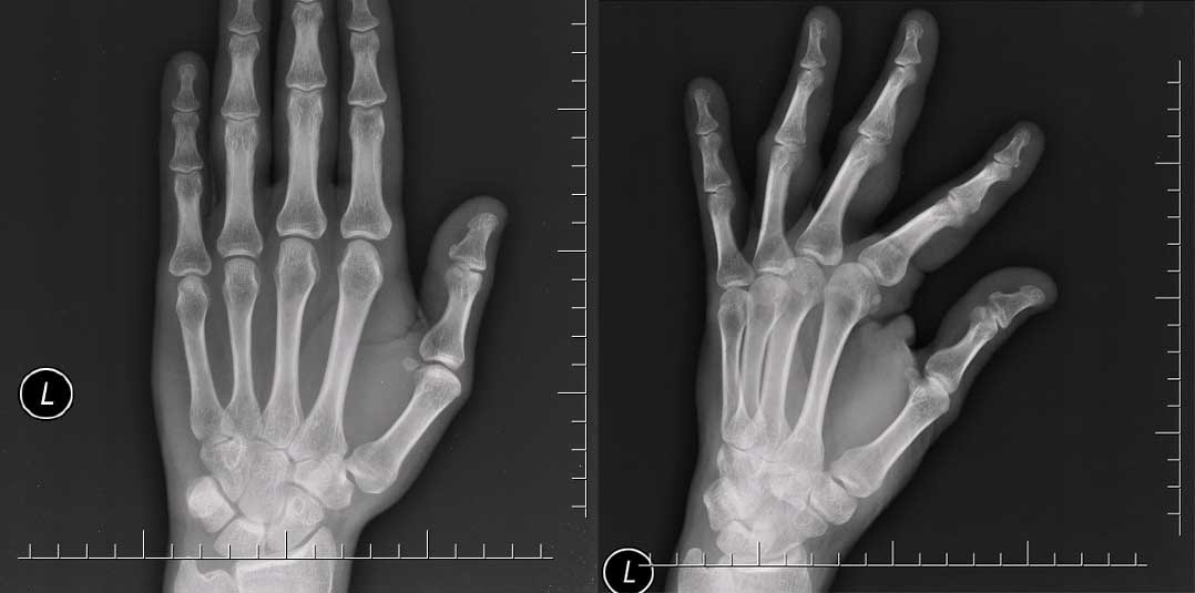 Frontal view of the hand