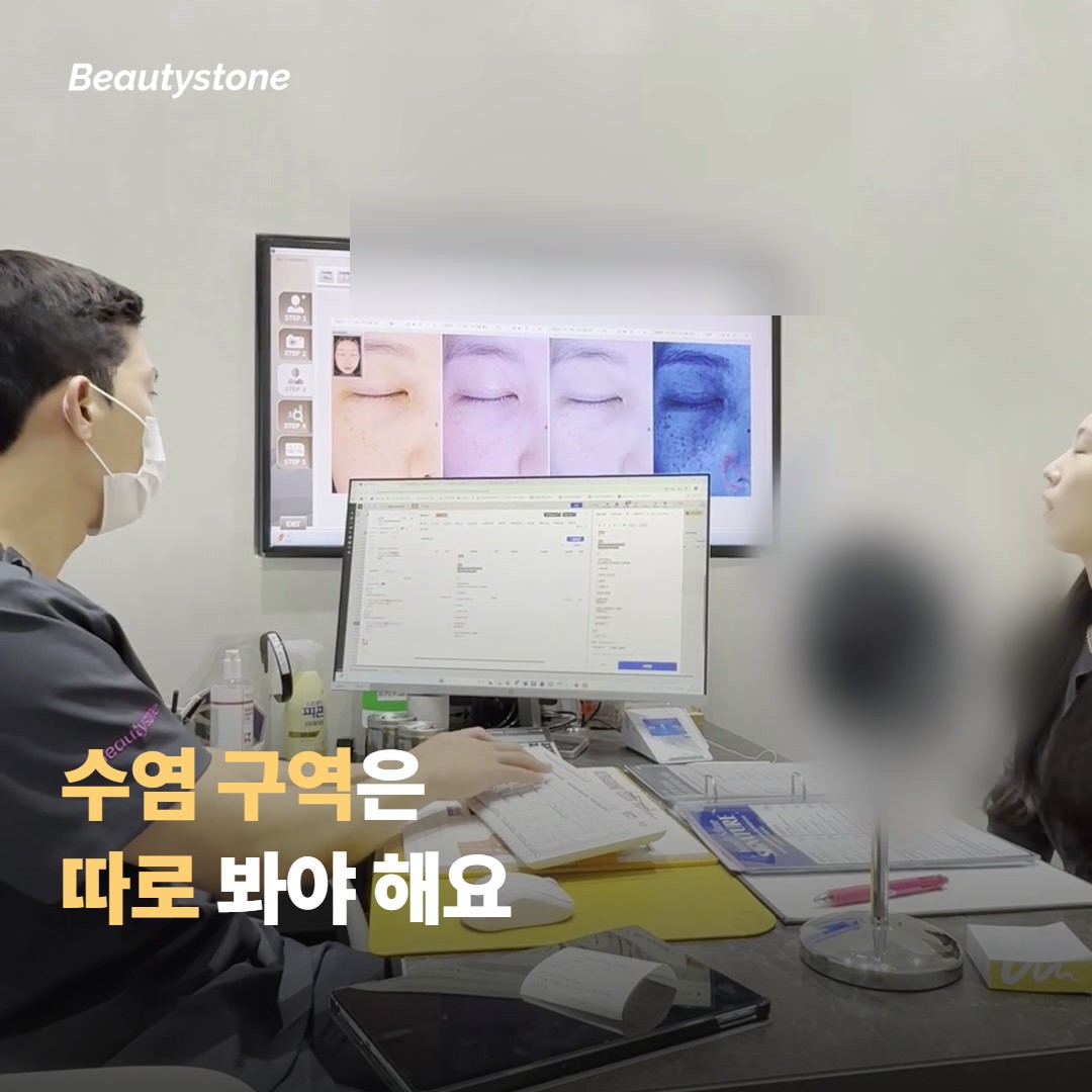 수염 부위에서 조심해야 할 점