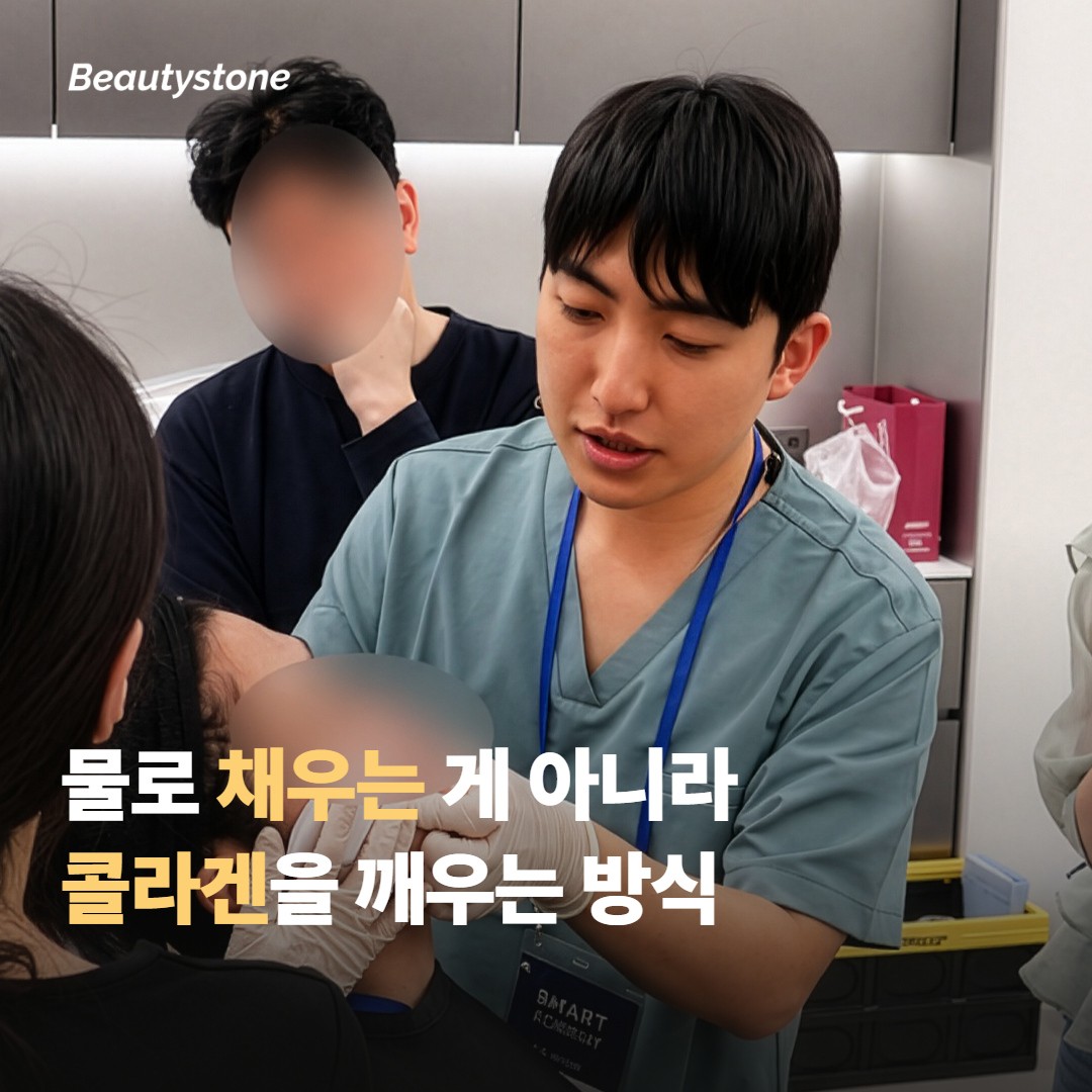 레디어스와 쥬베룩, 채우는 방식이 달라요