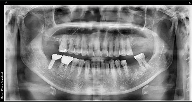 초진 파노라마