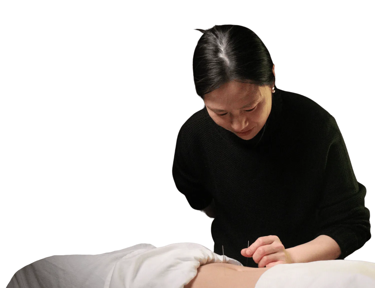 Acupuncturist placing a needle on a patient's stomach for chronic pain