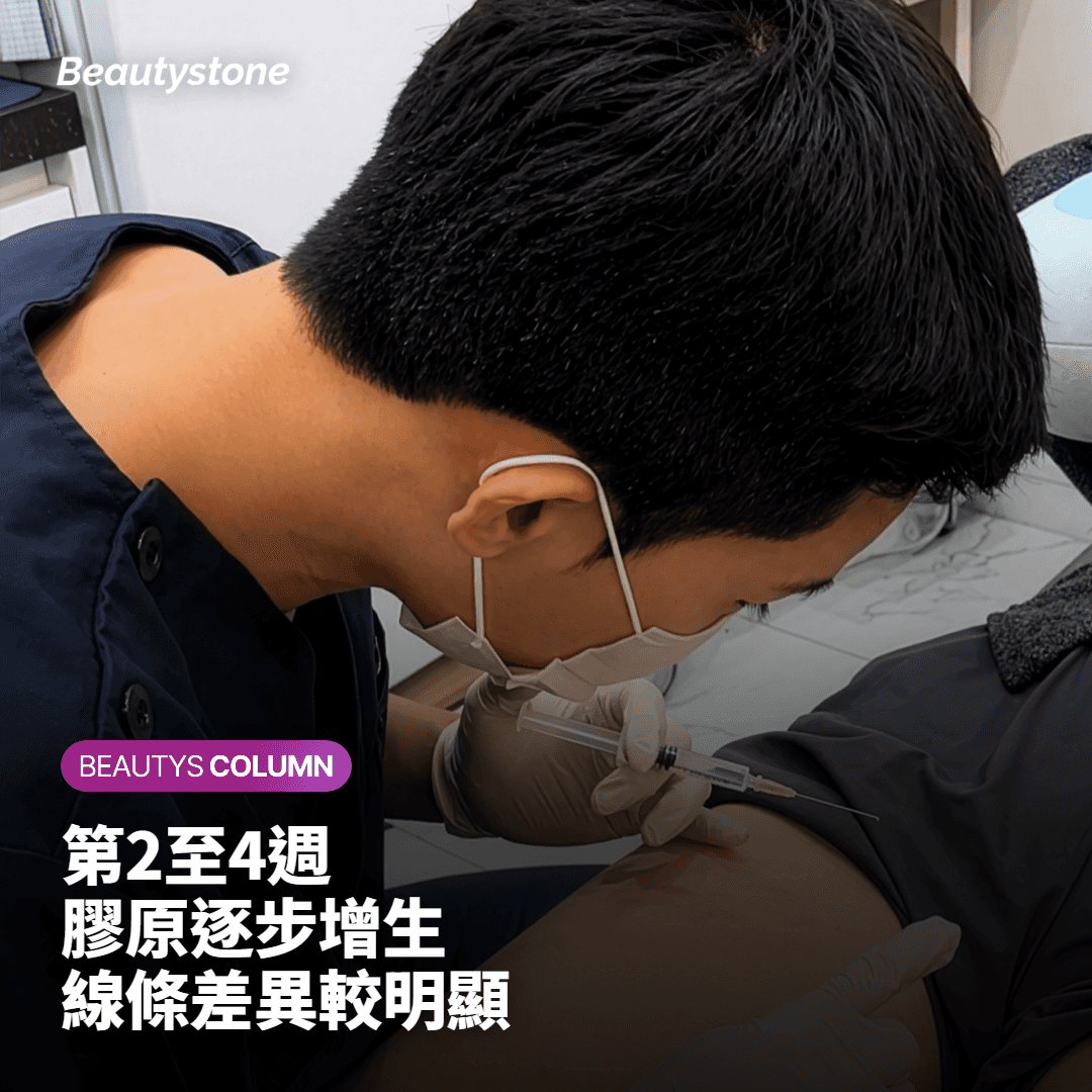 第二至四週膠原增生階段的變化說明卡片