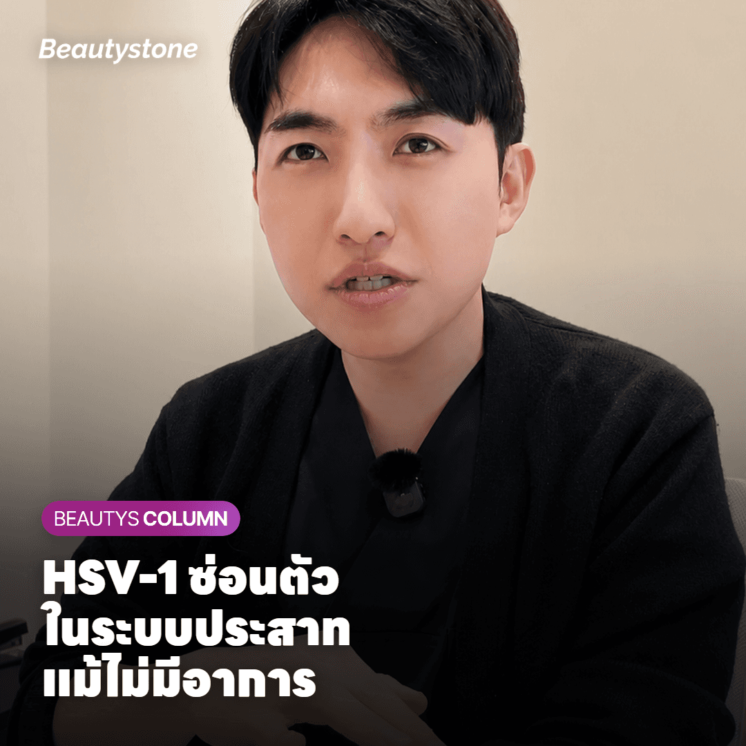 แผนภาพแสดงการซ่อนตัวของไวรัส HSV-1 ในปมประสาท Trigeminal บริเวณใบหน้า