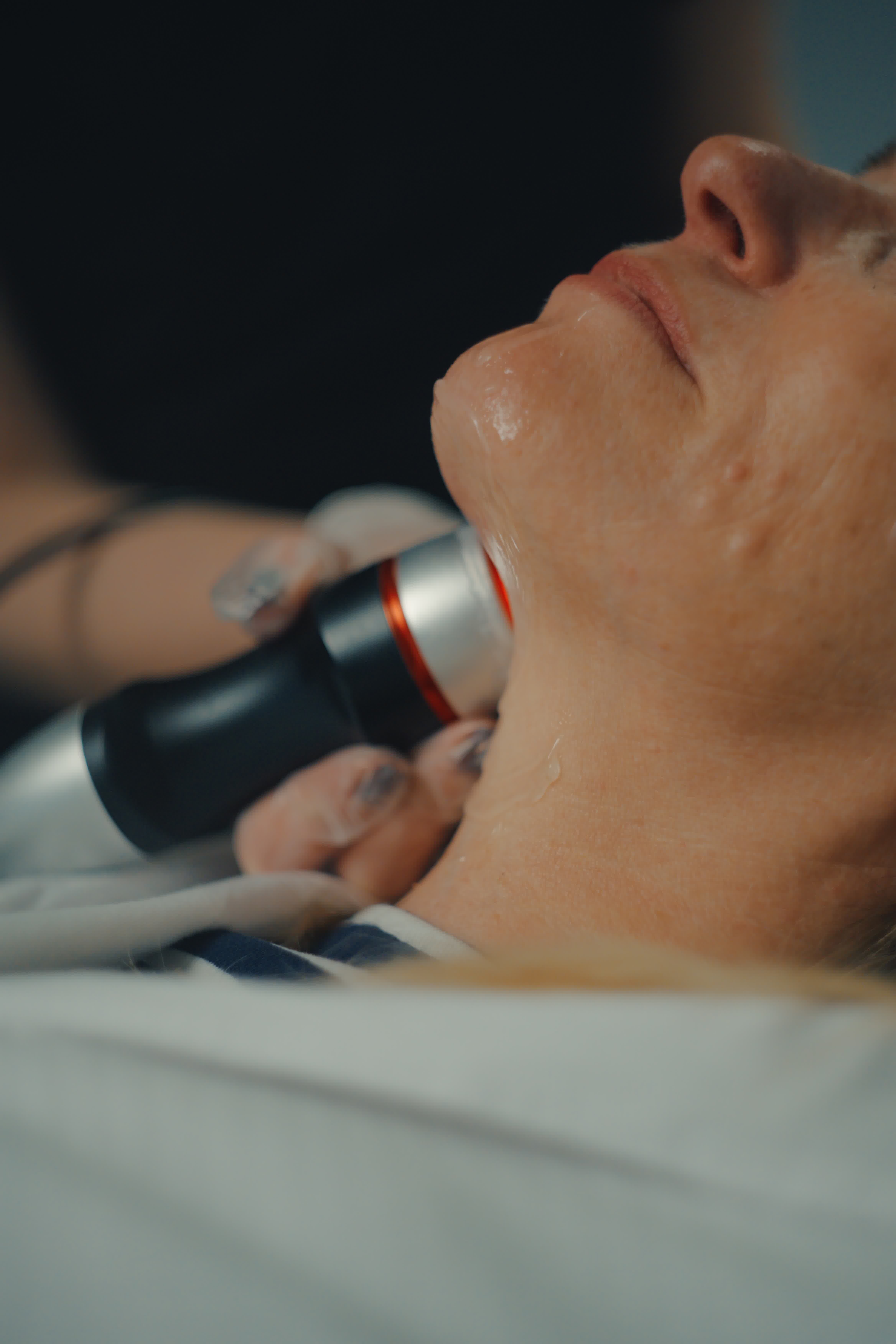 Laser treatment on woman's cheek with protective eye shield