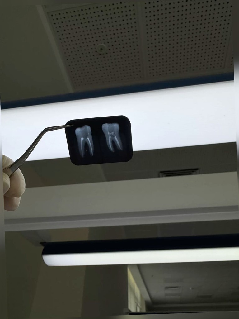 Teeth Checkup