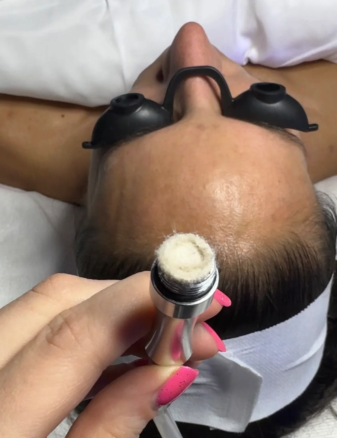 Marissa performing Microdermabrasion