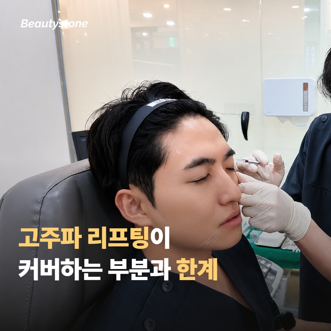 고주파 리프팅이 커버하는 부분과 한계