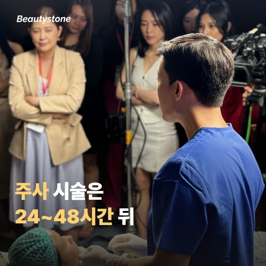 시술 종류별 시작 시점