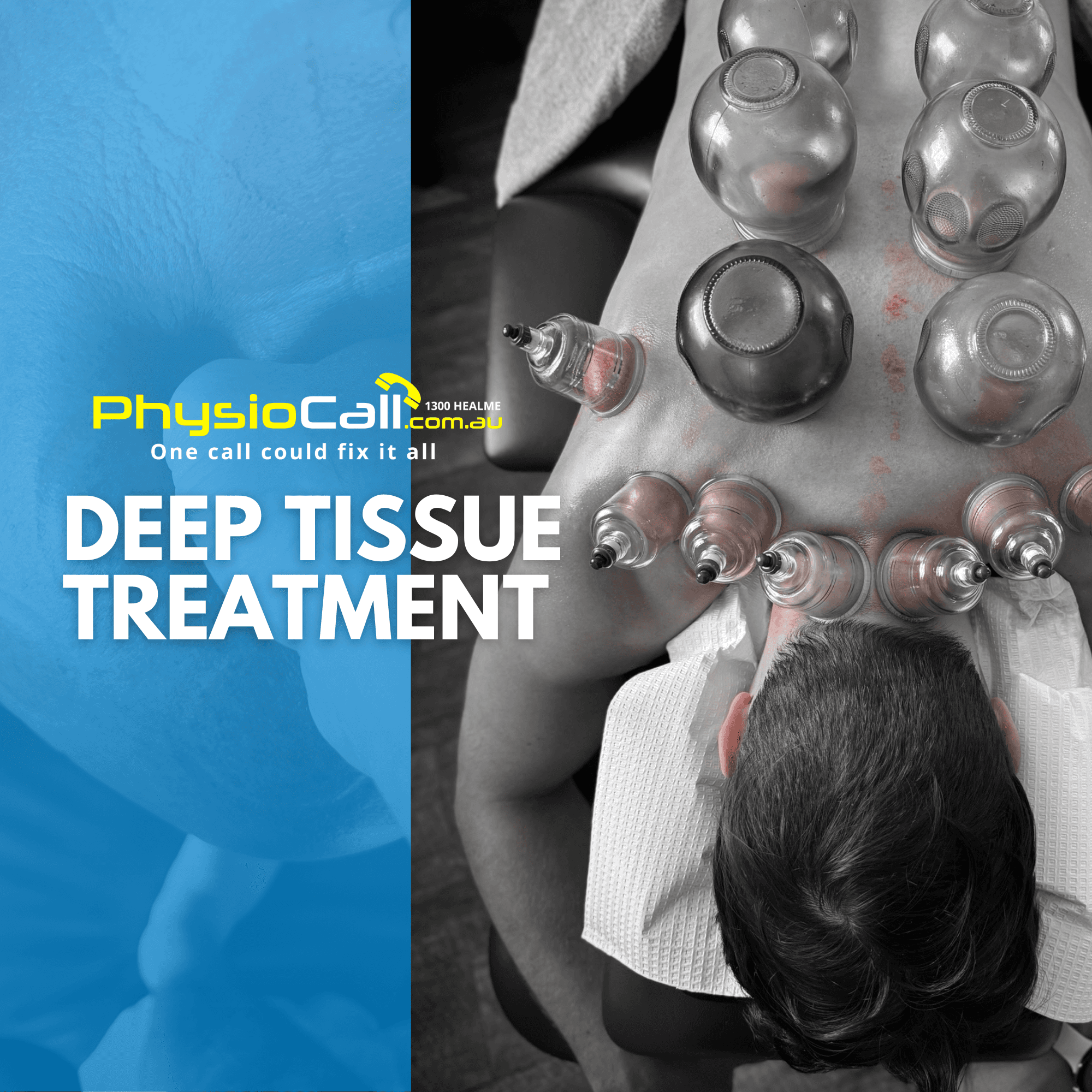 Deep Tissue Massage