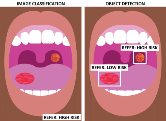 Image classification vs Object Detection in dental images 