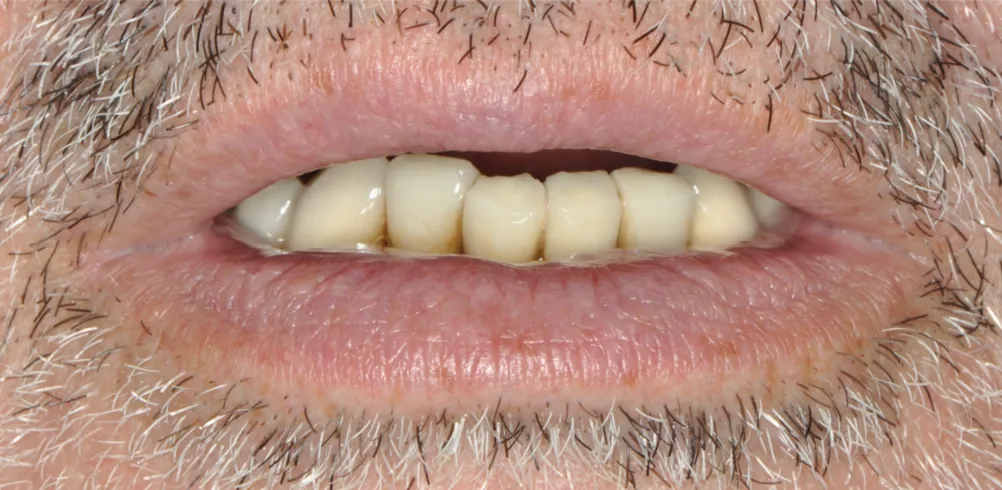 Before ortho treatment