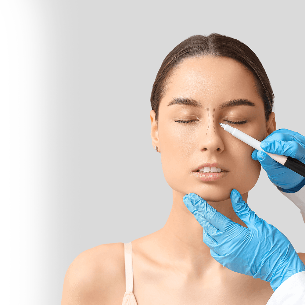 surgical planning of nose job