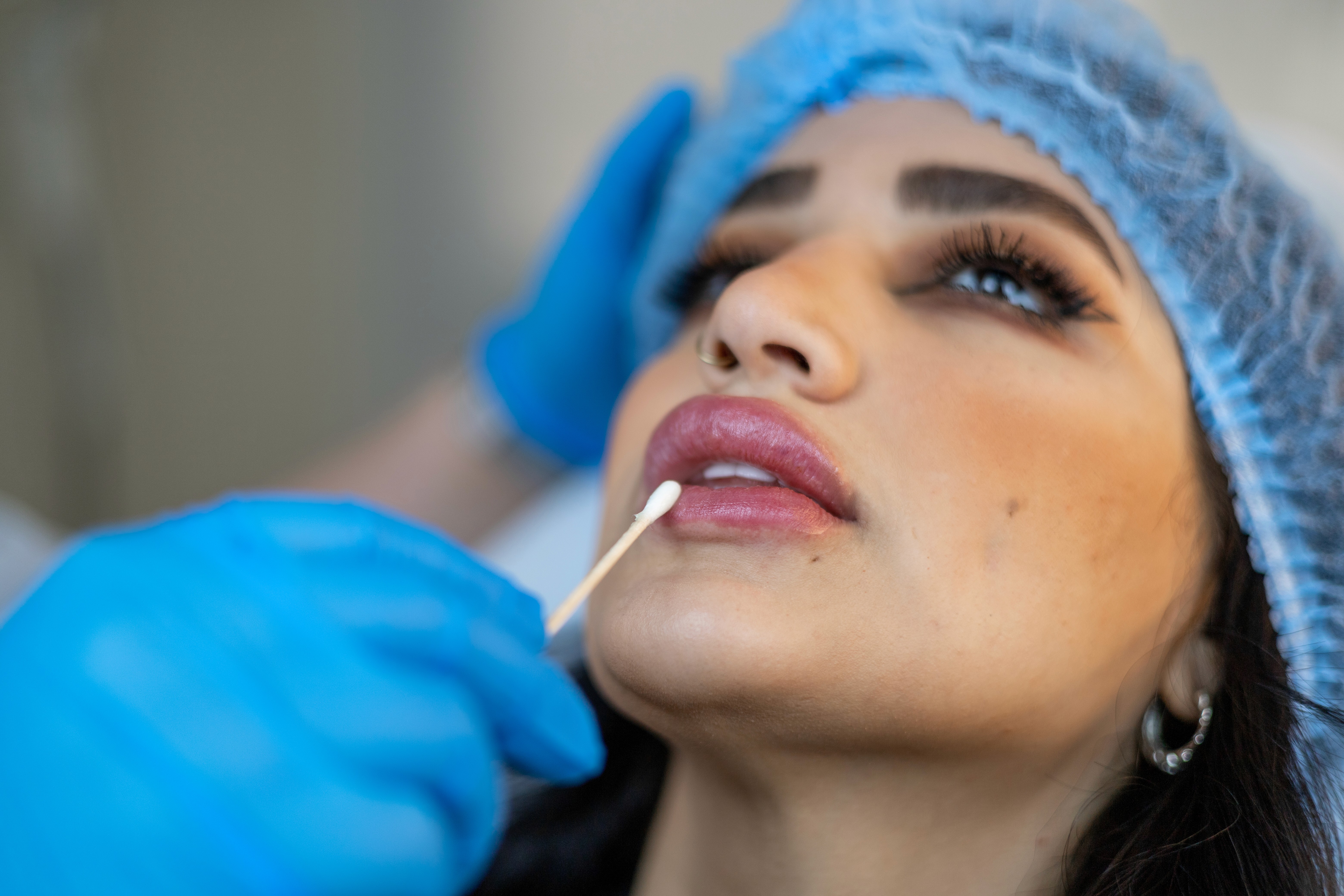 Natural lip fillers in Abu Dhabi. 