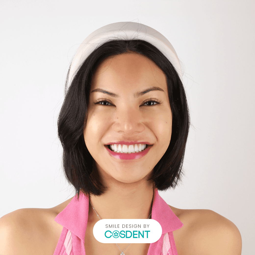 หน้าเพชร ยิ้มกว้าง 18 ซี่