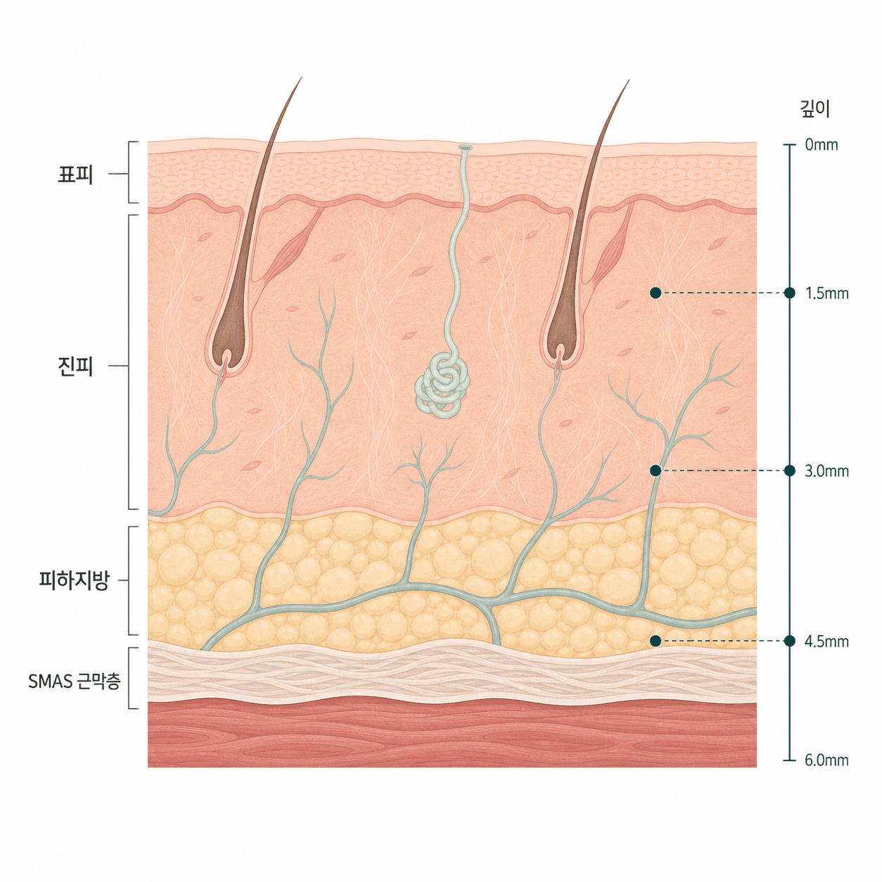 얼굴 피부층과 그 아래 SMAS 근막층의 깊이