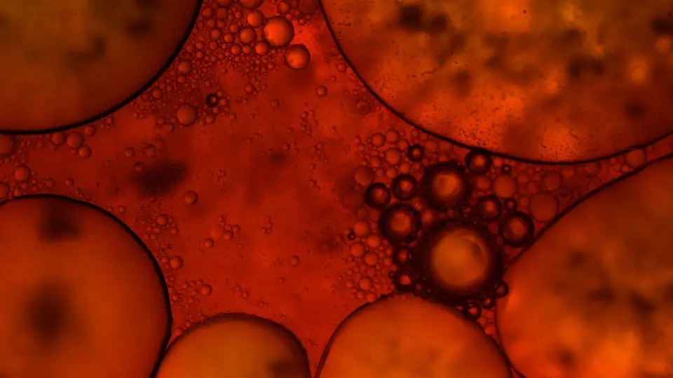 lipids and ceramides 