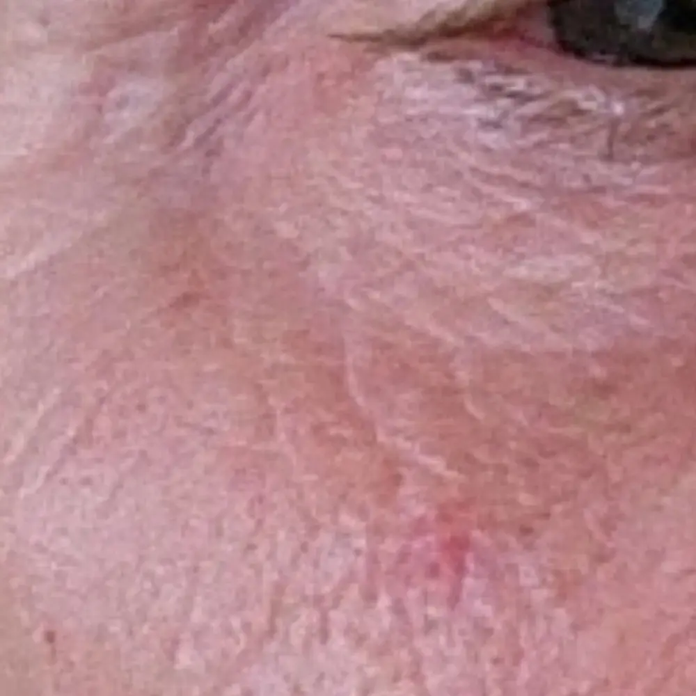 vancouver-aesthetician-hydrators-eye-area-wrinkles-hydrating-facial-series-after