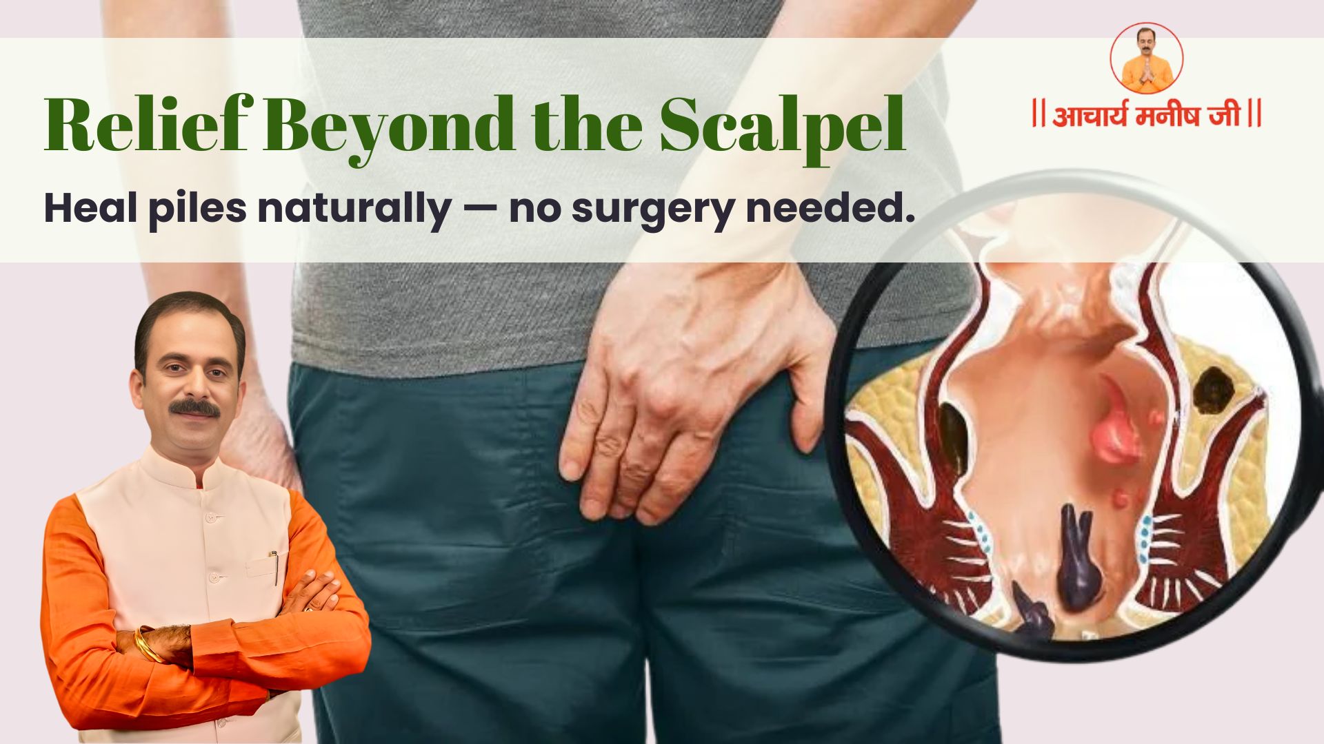 Can Piles Be Healed Without Surgery