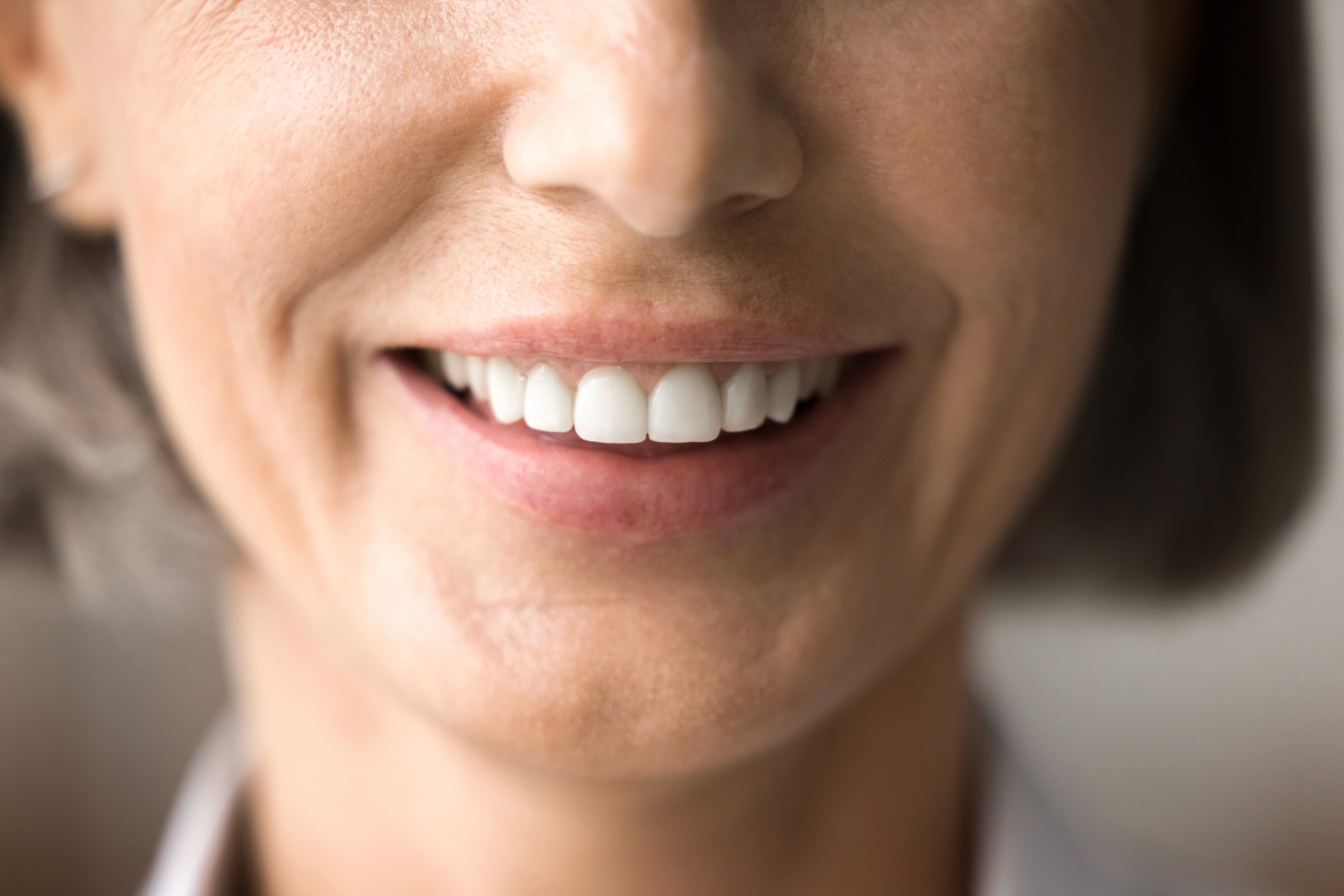 healthy smile after dental implant surgery at invisalign center