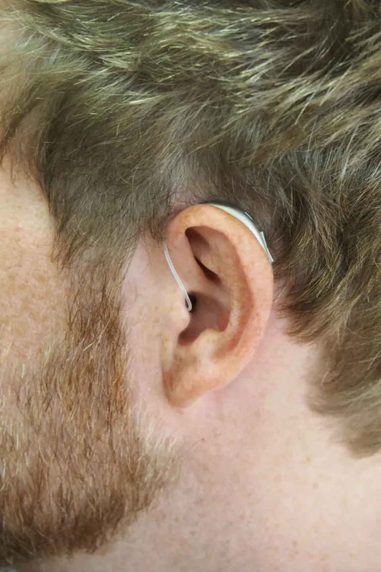 Image of male-presenting person with cochlear implant