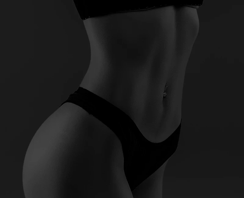 resultado de abdominoplastia — abdômen definido e postura melhorada