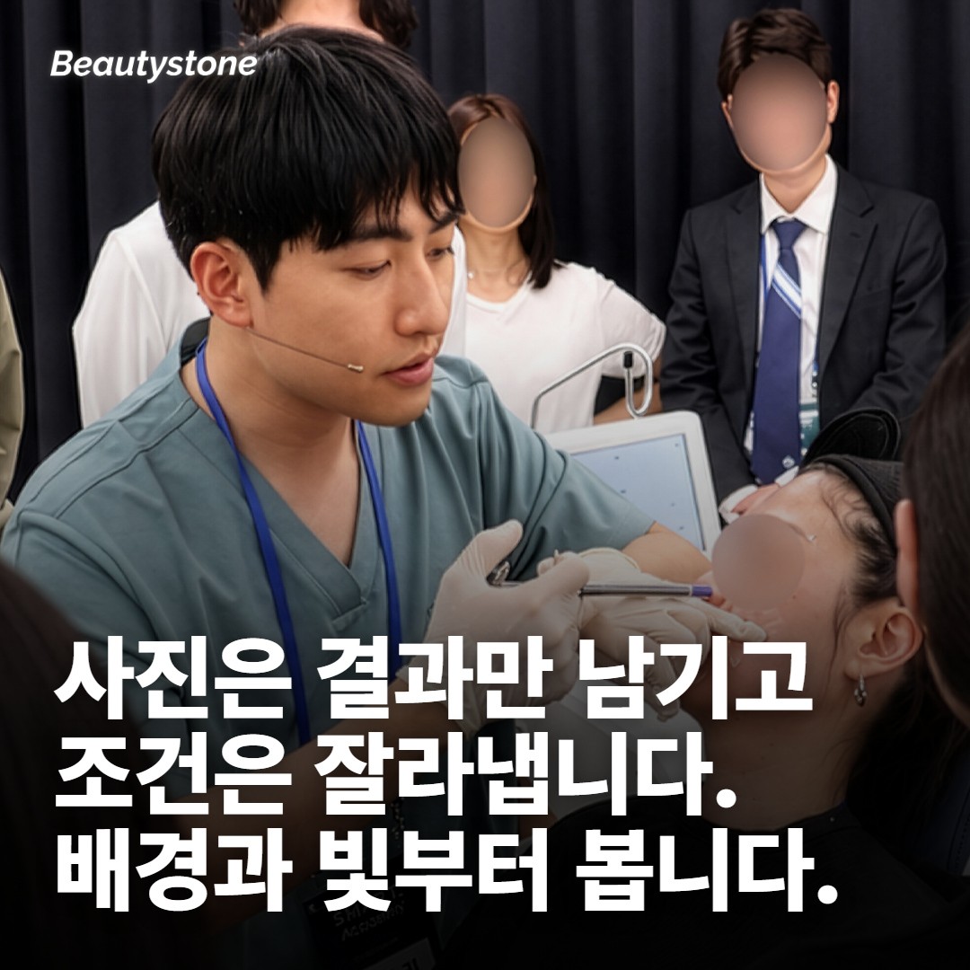 전후 사진은 결과만 보여주고 조건은 잘라냅니다