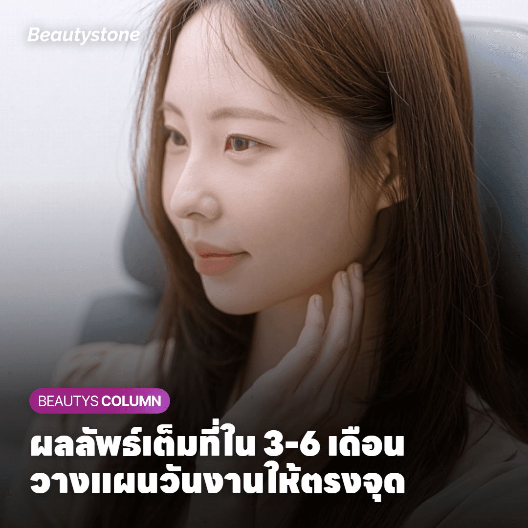 กราฟแสดงระยะเวลาการเห็นผลของ Sofwave ตั้งแต่สัปดาห์แรกถึง 6 เดือน