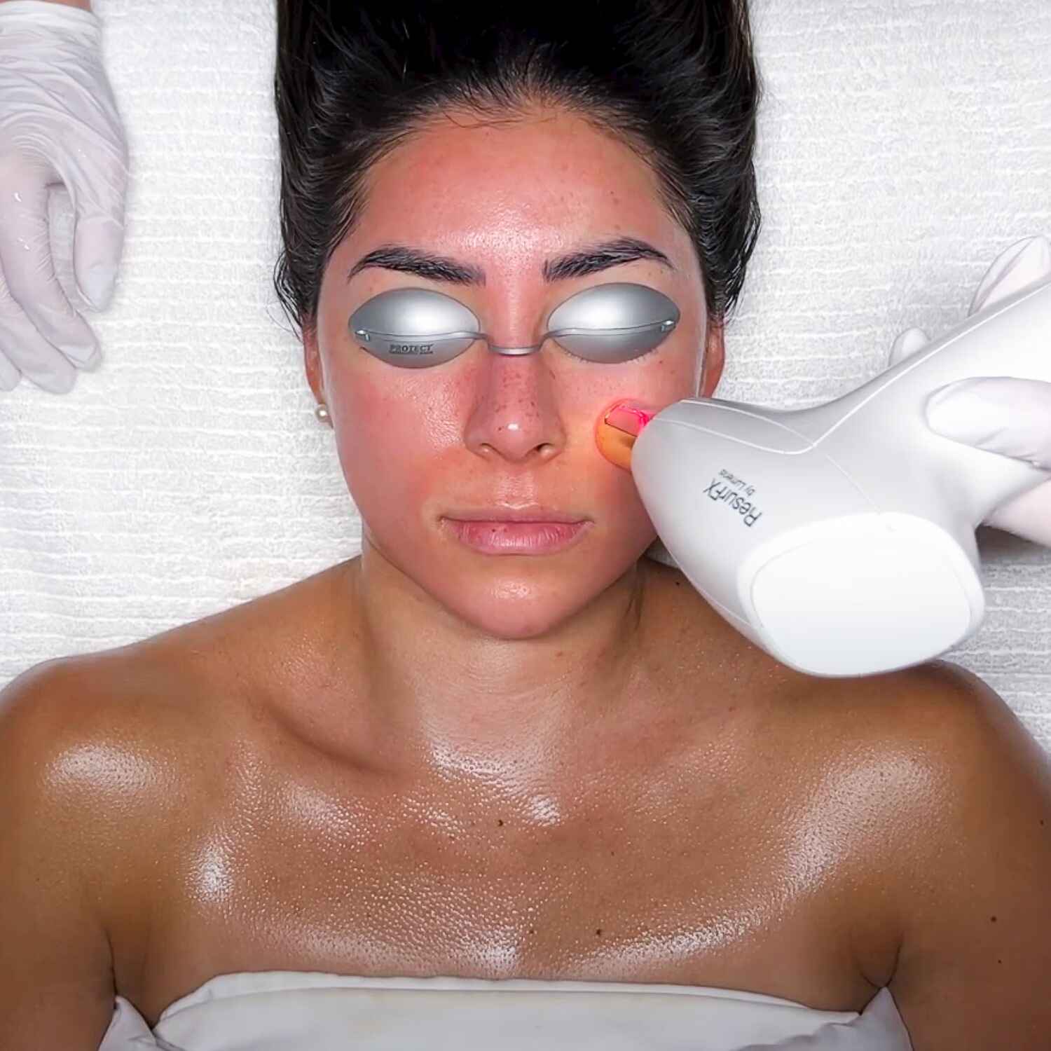 IPL Photofacial at Boho Med Spa in Allen, Texas.