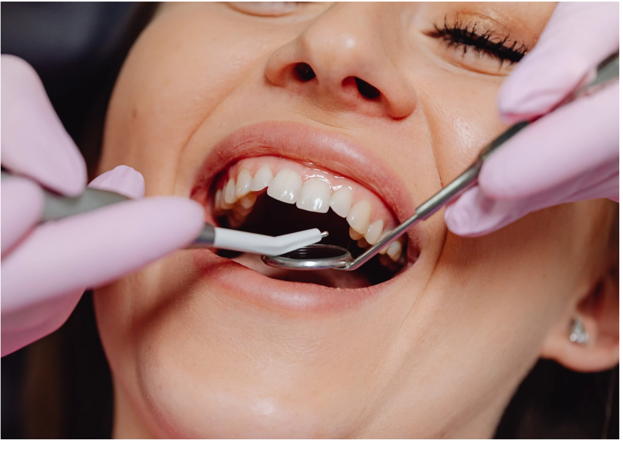 Patient under tandundersökning