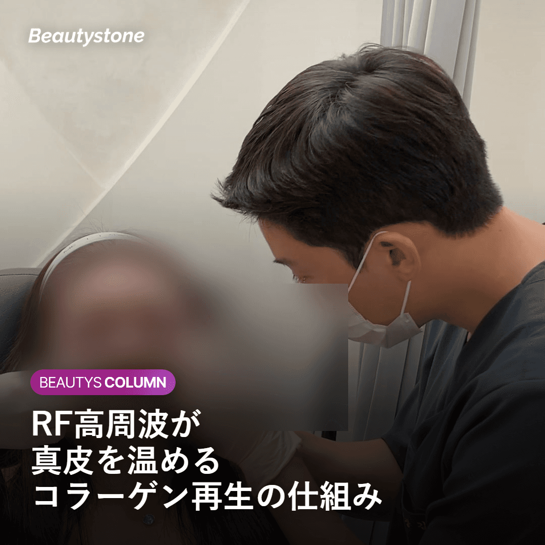 施術後4週間〜12週間のコラーゲンリモデリングのタイムライン
