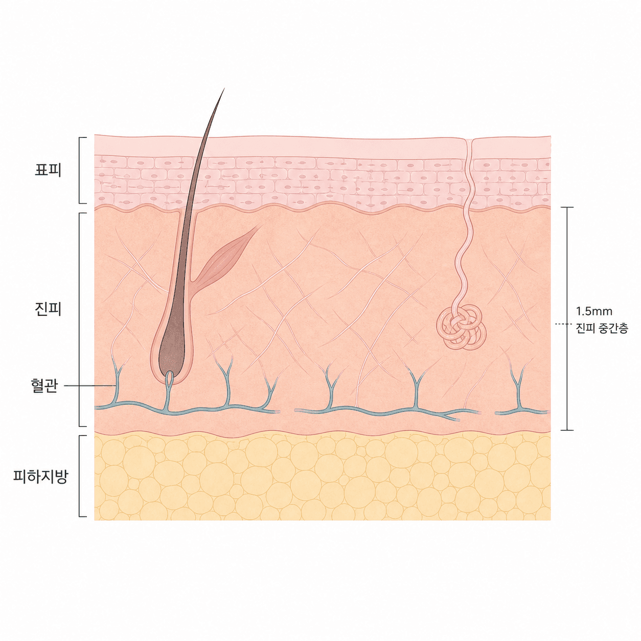 혈관이 좁아지며 피부로 가는 혈류와 산소가 줄어드는 모습이에요