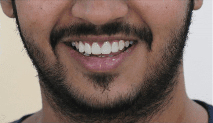 Image of patient smiling