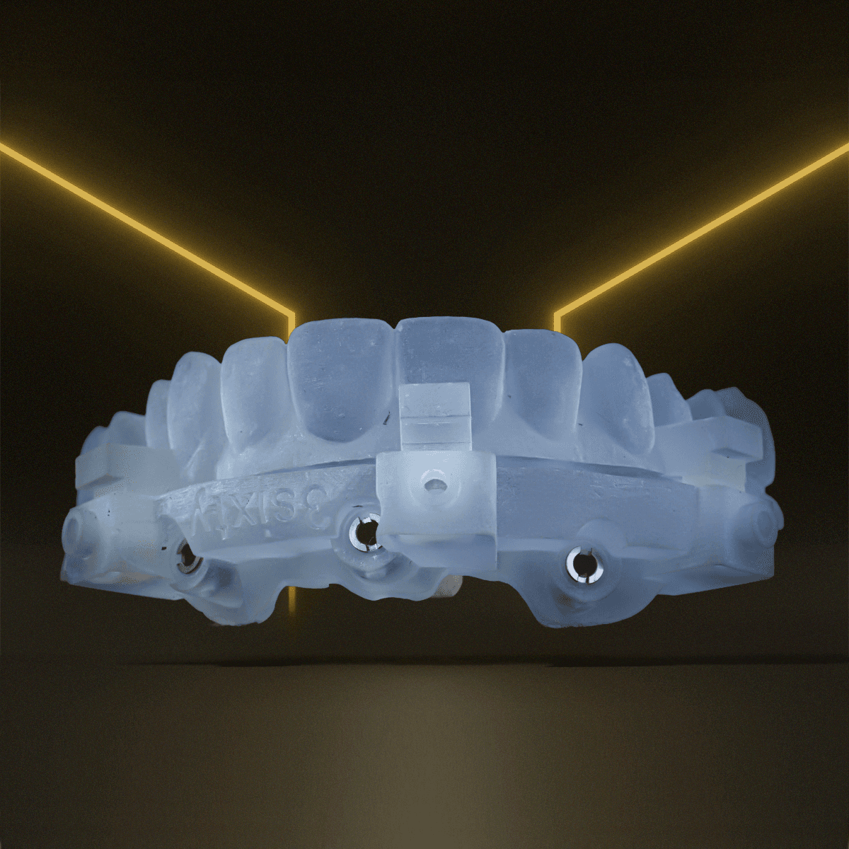 Digital Treatment Planning