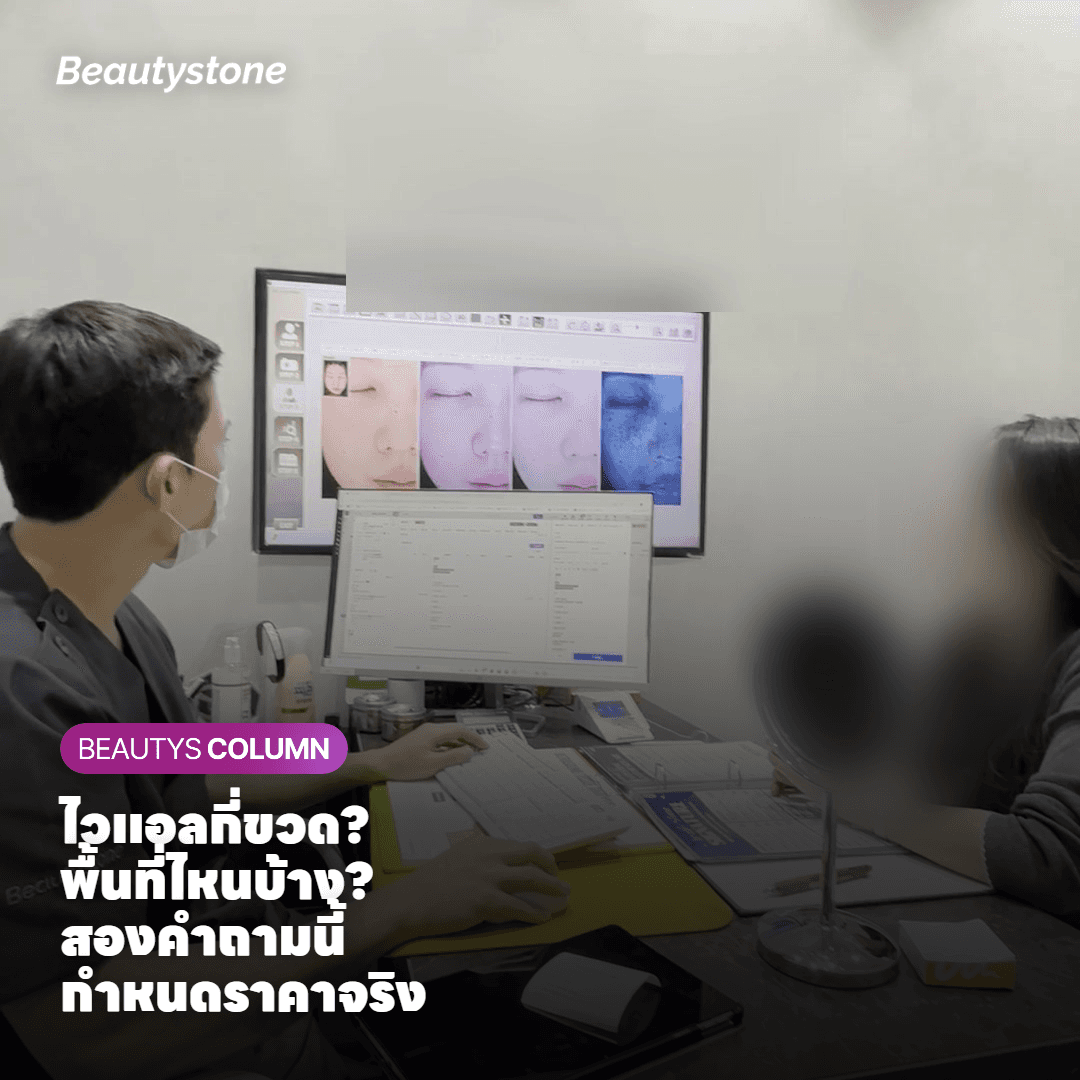 ต้องใช้กี่ไวแอลสำหรับแต่ละพื้นที่?