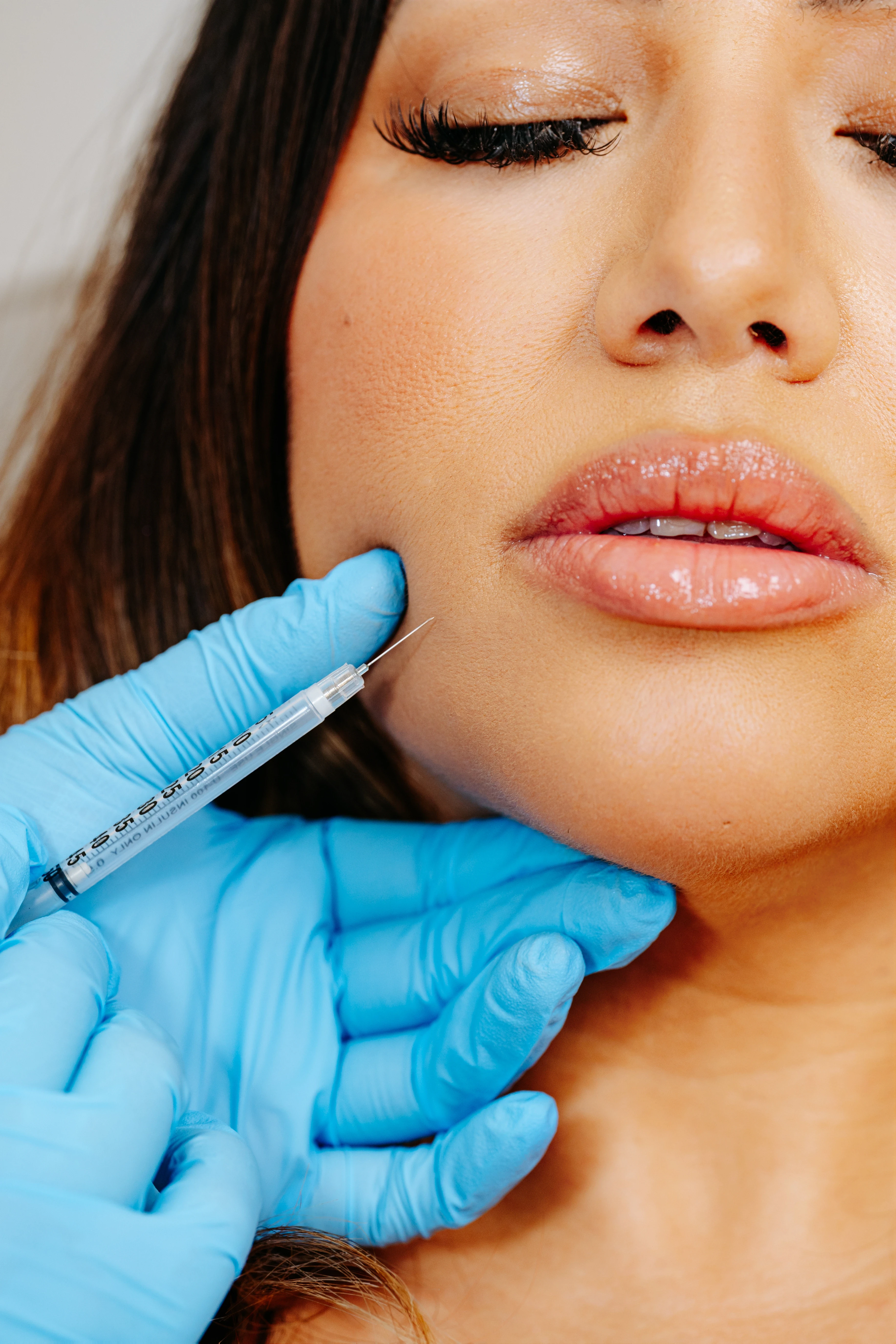 Botox treatment at Marie Shelley MedSpa Roseville for smoother, youthful skin