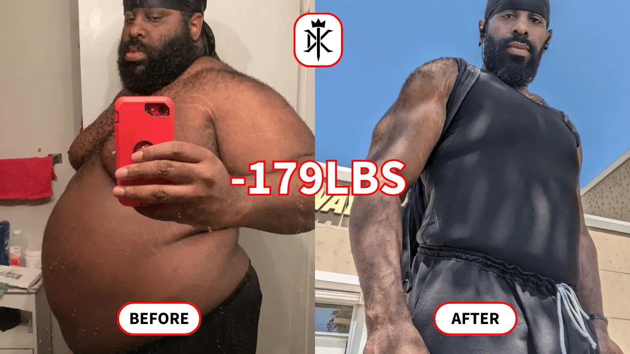  Default Kings  Henry Toliver Before and After 179 lbs Weight Loss Trasnformation Photo